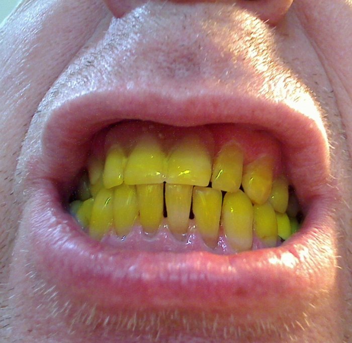 1.jpg